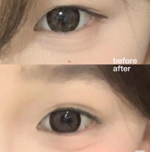 【19.9元抢240贴！一秒拯救肿眼泡】优丽莱日系双眼皮贴隐形自然，自然隐形 防水脱汗 易于上妆，橄榄尖角无痕蕾丝女自然单眼皮肿眼泡QQ 商品图1