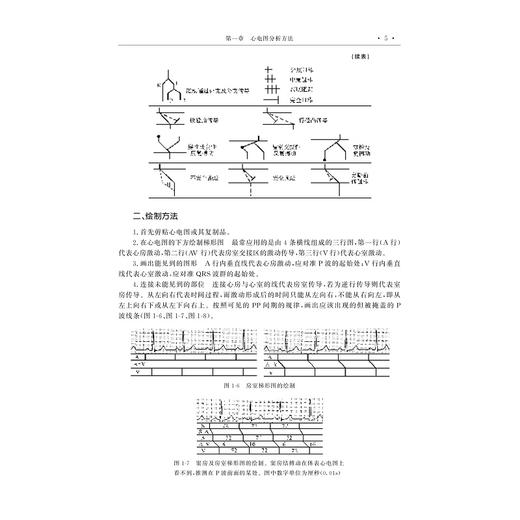 心电图学教学图谱（第二版）/高等院校数字化融媒体特色教材/主编 潘大明 潘医歌/浙江大学出版社 商品图4