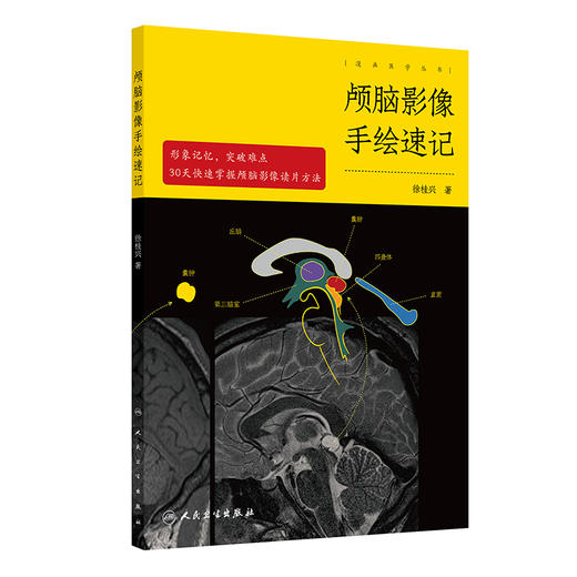 【预售】颅脑影像手绘速记 2024年9月参考书 商品图0