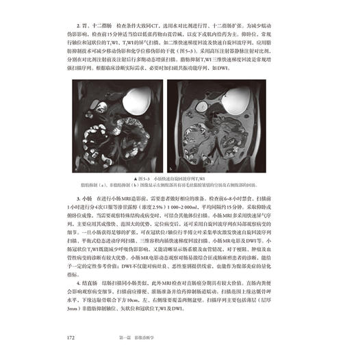 医学影像学第5版 成教专升本临床配增值 国家卫生健康委员会十四五规划新形态教材 全国高等学校教材9787117363648人民卫生出版社 商品图4