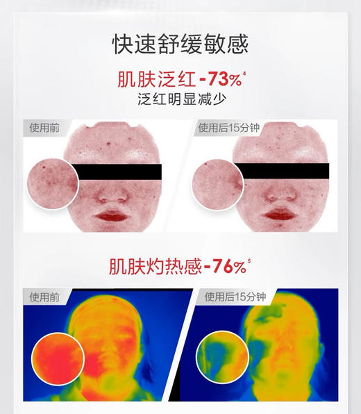 【海关监管】薇诺娜舒敏特护霜-舒缓修护敏感肌-补水保湿滋润-会员5折 商品图4