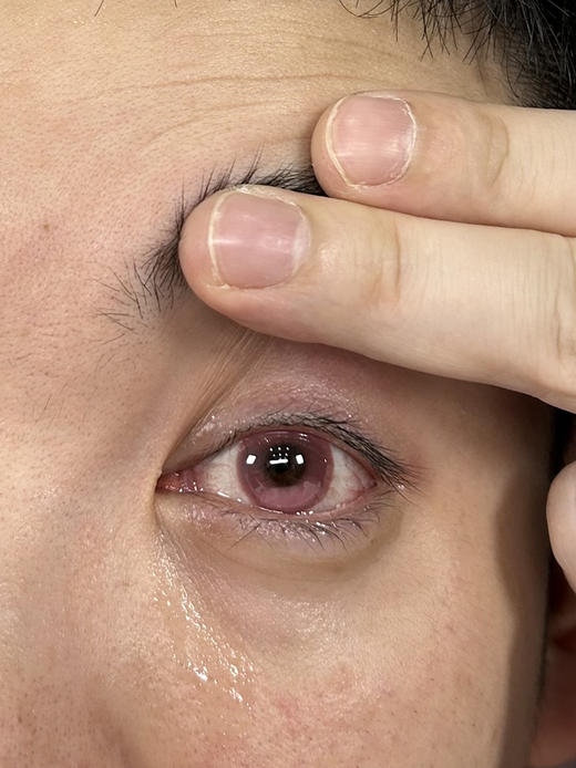 CN 腥红之月 半年抛 2片 14.5mm 参考着色14.0 基弧8.5 含水40% 新锐国货 商品图2