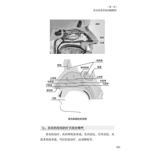 中医名家小妙招系列 鼻炎就这么治 经常抠鼻子会不会导致鼻炎 鼻炎患者常见问题解答养生保健田道法编9787117356220人民卫生出版社 商品图4