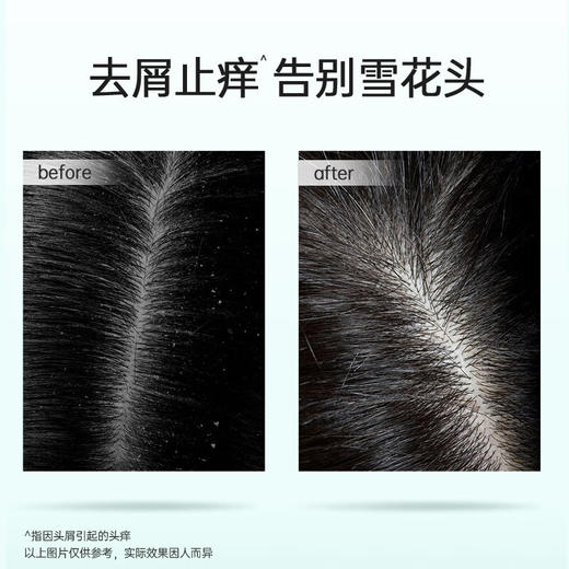 【品牌直发】滋源茶籽控油去屑/沁爽洗头套装 商品图4