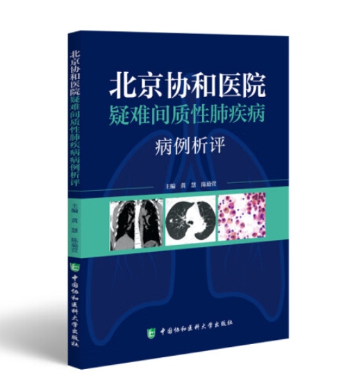 北京协和医院疑难间质性肺疾病病例析评