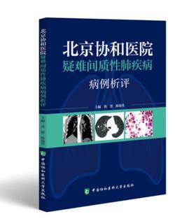 北京协和医院疑难间质性肺疾病病例析评