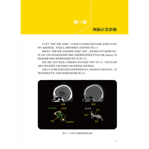 颅脑影像手绘速记 颅脑正常影像 高血压性脑出血 脑静脉出血和静脉窦血栓形成 颅内肿瘤 主编 徐桂兴 9787117364225人民卫生出版社 商品图4