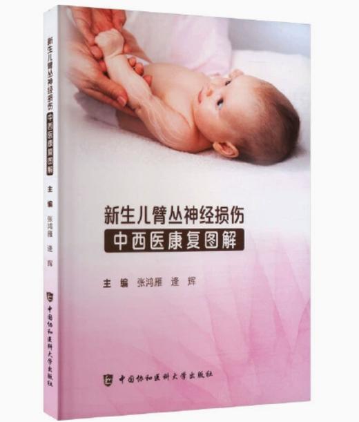 新生儿臂丛神经损伤中西医康复图解 商品图0