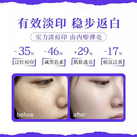 【专柜小样】美国 Kiehl's科颜氏 焕白淡斑精华 4ml 商品图4