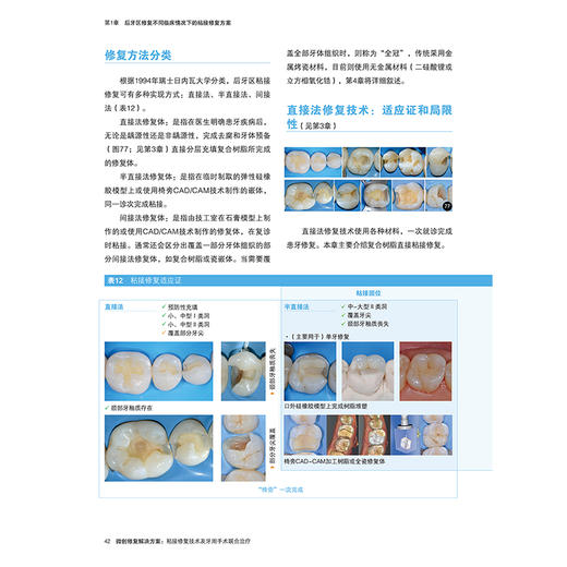 全2册微创修复解决方案2本套装非龋性牙体硬组织疾病 牙体修复概论 传统粘接固位修复体 刘擎主译9787559135346辽宁科学技术出版社 商品图3