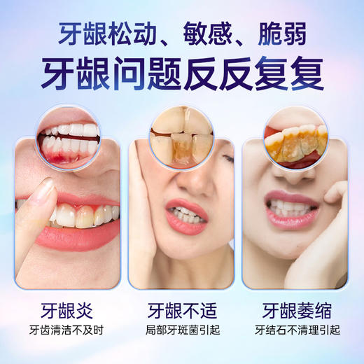 牙科分离剂牙膏牙龈部位型 商品图1