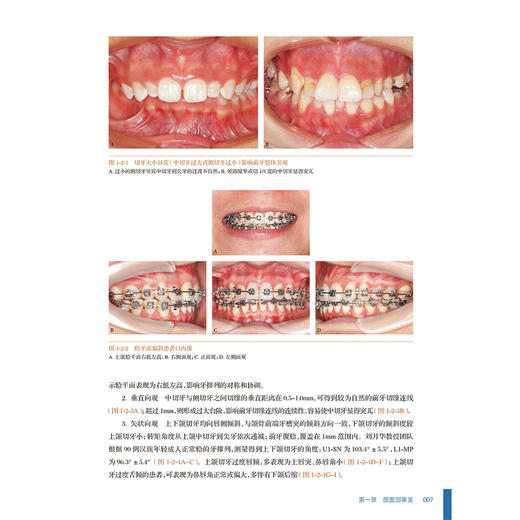 突面畸形的正畸策略及技术 颜而部审美的认知演变 口腔正畸治疗的美学目标 鼻唇关系 主编刘月华 9787117367646人民卫生出版社 商品图4