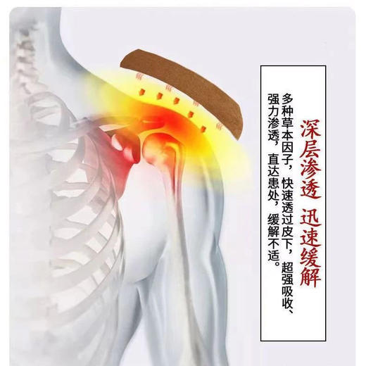 【哪痛贴哪 一贴见效】鑫康泰蜈蚣贴 蜈蚣成分 熬制成膏 植物中药萃取精油 商品图6