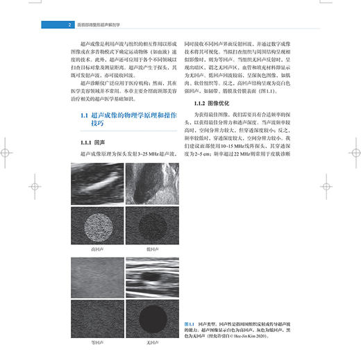 面颈部微整形超声解剖学 超声成像基本原理 额畈尔超卢解剂 眶周区超声解剂 主译张文俊 聂兵等 9787547866672上海科学技术出版社 商品图3