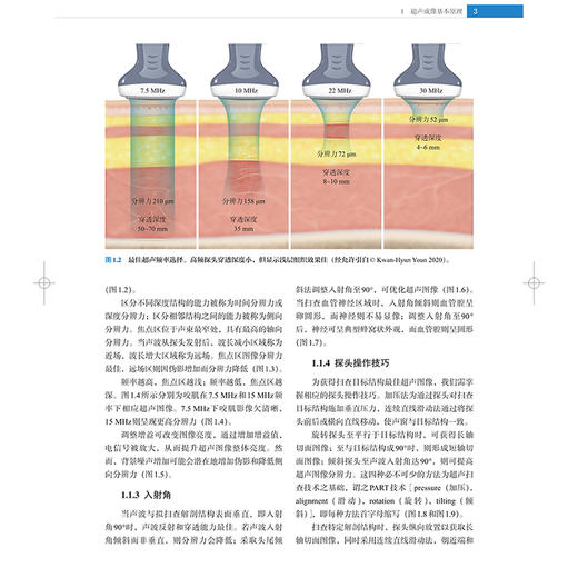 面颈部微整形超声解剖学 超声成像基本原理 额畈尔超卢解剂 眶周区超声解剂 主译张文俊 聂兵等 9787547866672上海科学技术出版社 商品图4