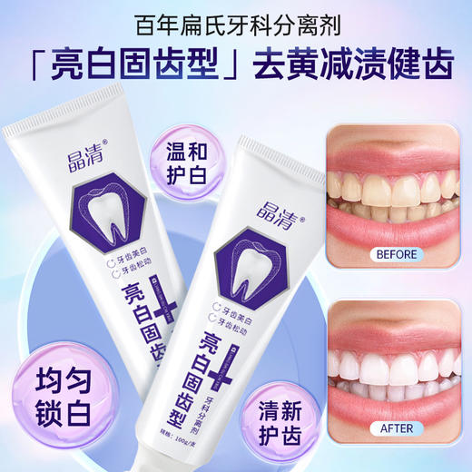 牙科分离剂牙膏亮白固齿型 商品图3