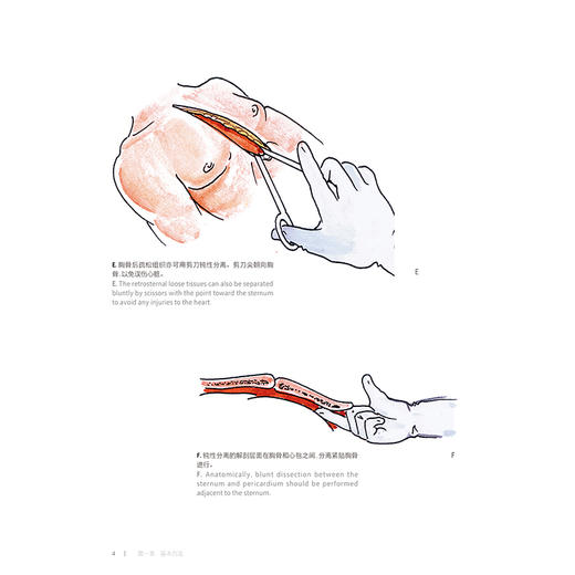 成人心脏外科名家手术手绘图解 汉英对照 胸骨正中切口 体外循环插管外科学主编刘中民 翁渝国 李颖则9787117362641人民卫生出版社 商品图4