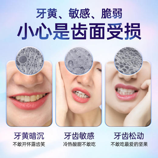 牙科分离剂牙膏亮白固齿型 商品图2