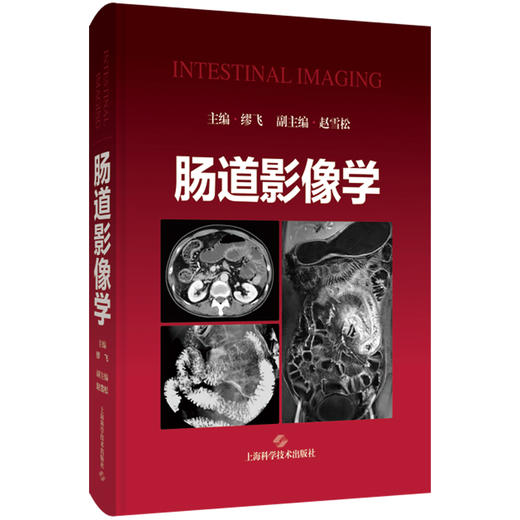 肠道影像学 小肠的解剖 组织发生和生理 小肠疾病的诊断流程 结肠疾病的检查方法 主编 缪飞 9787547867846 上海科学技术出版社 商品图1