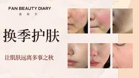 护肤小课堂——换季护肤攻略