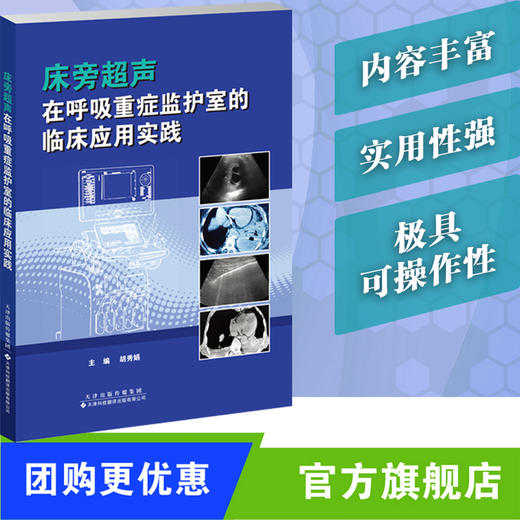 床旁超声在呼吸重症监护室的临床应用实践  超声 重症监护 床旁超声 ICU 商品图0