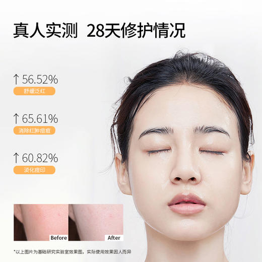 【屏障修护套组】铂鱼小金鱼水乳霜套组械字号医用胶原蛋白医美补水舒缓泛红敏感修复亢炎 商品图3