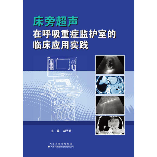 床旁超声在呼吸重症监护室的临床应用实践  超声 重症监护 床旁超声 ICU 商品图4