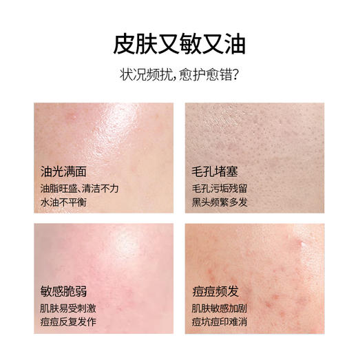 【铂鱼祛痘1.0 清洁控油祛痘】铂鱼祛痘修护洁面慕斯 水 精华  肌肤痤疮粉刺 毛孔粗大 痘印 械字号医用胶原蛋白医美补水舒缓泛红敏感修复T 商品图4