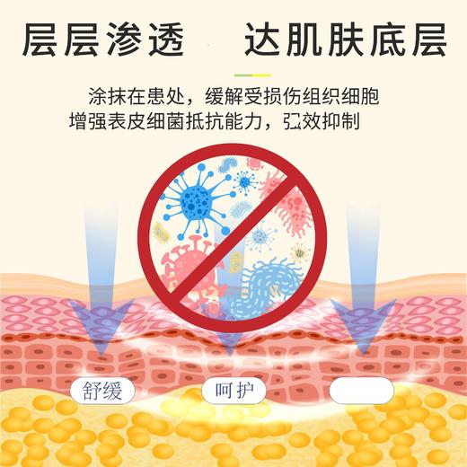 苗疆止痒王软膏皮肤瘙痒癣痒湿毒外用抑菌乳膏 20g 商品图1