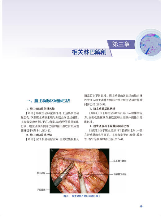 宫颈癌手术图解 人卫宫腔镜盆底盆腔肿瘤解剖女性妇科疾病实用产科超声指南手册妇产科学手术视频图谱学医学书书籍人民卫生出版社 商品图4