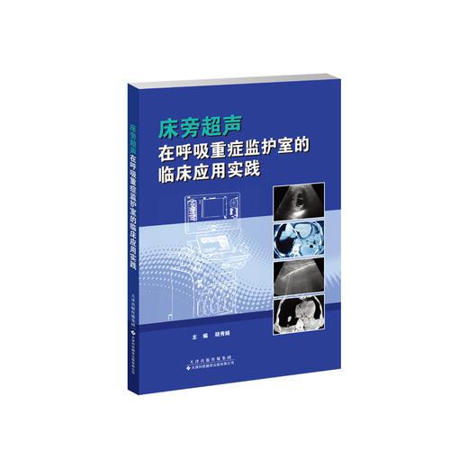 床旁超声在呼吸重症监护室的临床应用实践  超声 重症监护 床旁超声 ICU 商品图1