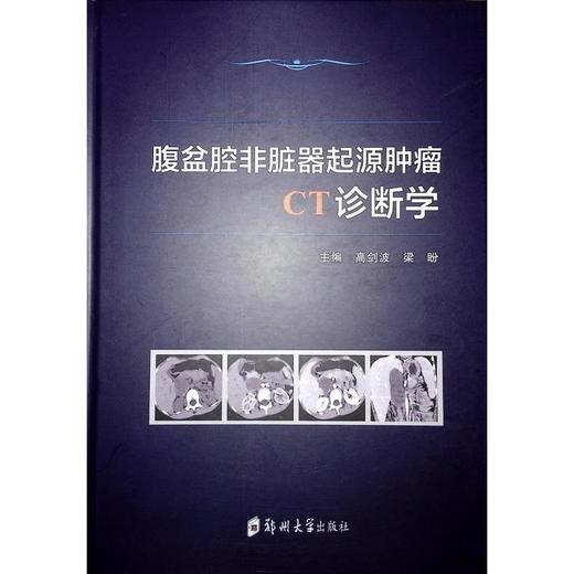 腹盆腔非脏器起源肿瘤CT诊断学 商品图0