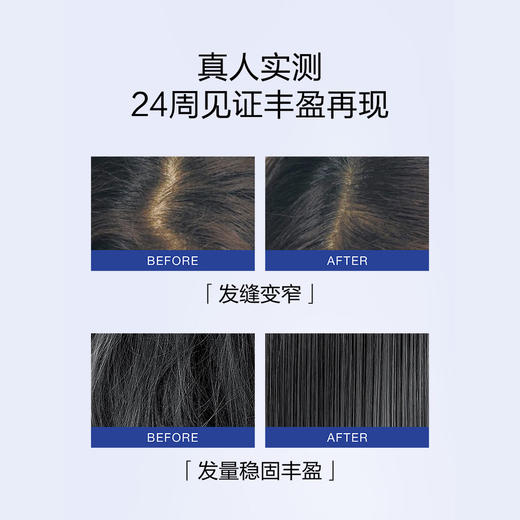 防脱育发｜No Age生发液+洗发水+护发素 日本进口 MUNOAGE防脱生发液 丰盈秀发弹性强韧 粗壮 无添加剂 商品图11