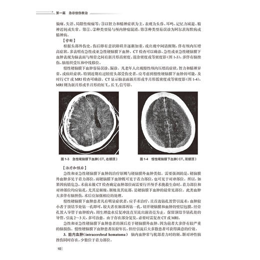 创伤与急症救治 颅脑损伤救治 颈部伤救治 颌面部伤救治 高血压急症 急性呼吸衰竭 主编尹文 黄杨等 9787117364058人民卫生出版社 商品图4