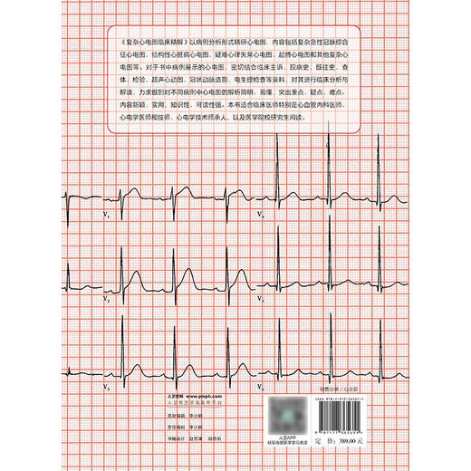 复杂心电图临床精解 2024年10月参考书 商品图2