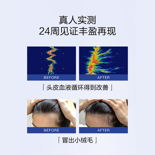 防脱育发｜No Age生发液+洗发水+护发素 日本进口 MUNOAGE防脱生发液 丰盈秀发弹性强韧 粗壮 无添加剂 商品图5