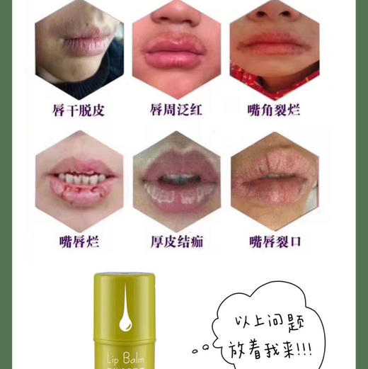采华之滋·蜂蜜润唇膏小绿胖子 嘴唇干裂滋润保湿成分安全 商品图2