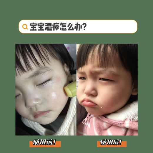 采华之滋·蜂蜜润唇膏小绿胖子 嘴唇干裂滋润保湿成分安全 商品图10