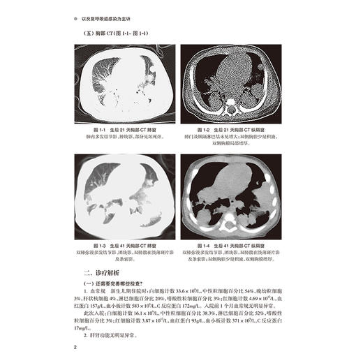 华西儿童罕见病病例集 继续医学教育教材 慢性肉芽肿病 先天性高胰岛素血症 新生儿糖尿病 主编吴瑾等9787117367196人民卫生出版社 商品图4