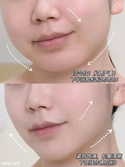 介绍链接丨新加坡枫缇Ble de FontyV脸精华针对水肿/发腮/下颌线模糊，常年断货！效果牛到你无法想象❗️保湿修护面霜“亢衰+修护+保湿+提亮”4重功效一瓶搞定 商品图6