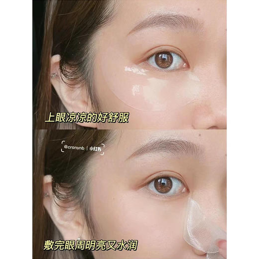 贵妇眼膜丫鬟价！奥伦纳素冰白眼膜1对 紧致淡纹去黑眼圈 商品图3
