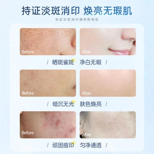 儒意本活亮肤美白祛斑精华1.5ml*30支 持证美白专利淡斑  | 儒意官方商城 商品图3