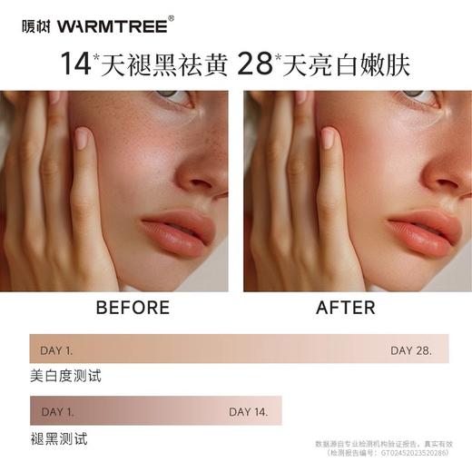【330元会员福利】暖树·美白淡斑精华油30ml送10ml+冻干面膜1盒  商品图4