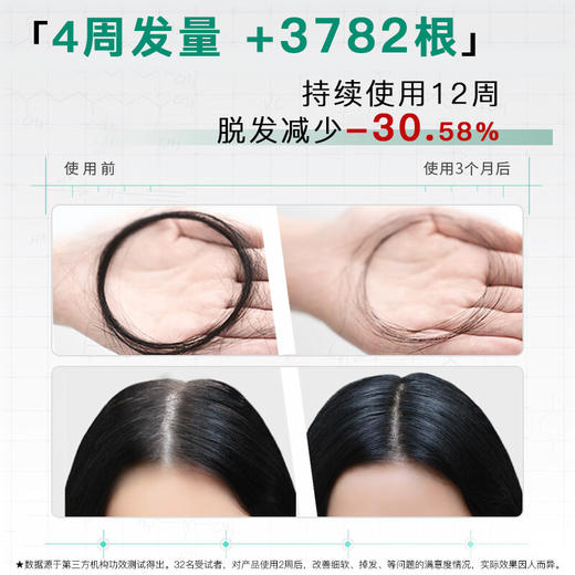 域发植优研防脱滋养洗发露洗发水300ml 防脱发腺苷固发 商品图5