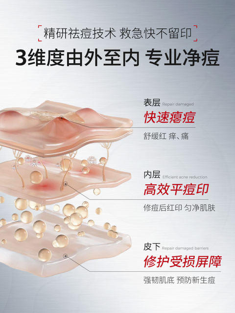 NING祛痘印修复淡化痘痘膏 去消痘坑痘疤印凝胶男女 商品图1