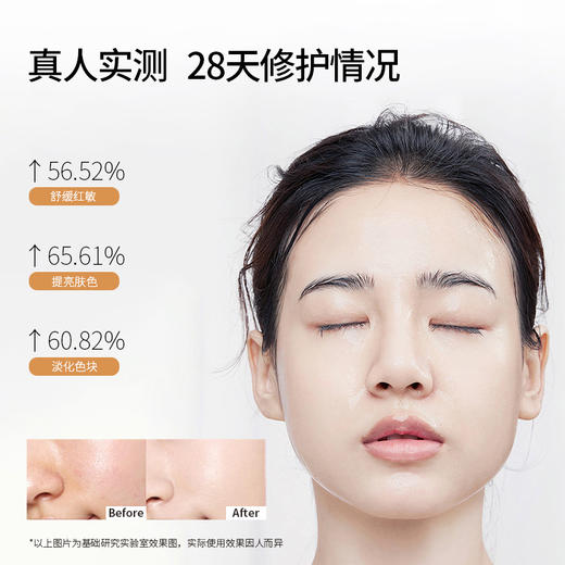 【铂鱼焕白3.0 一套直击斑·敏·红】铂鱼焕白水 精华 乳 霜  敷贴非面膜 肌肤提亮 修护色沉 斑点 械字号医用胶原蛋白医美补水舒缓泛红敏感修复 商品图4