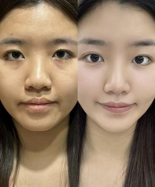 雅S兰黛旗下蓝魅系列红石榴祛黄保湿抗皱焕颜套装 商品图10