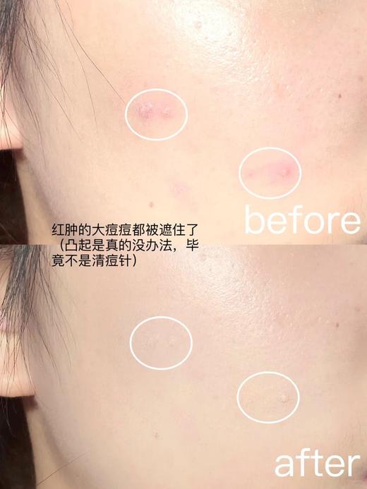 毛戈平MAOGEPING无暇精准遮瑕膏2.5g/个 人间橡皮擦 精准遮瑕，以色矫色！ 商品图6