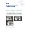肝门部胆管癌手术要点与难点 姜小清 吴小兵 胆道肿瘤诊疗教程系列 海军军医大学 胆道恶性肿瘤专病诊治中心 人民卫生出版社 商品缩略图4