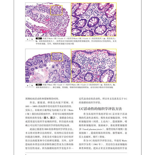 正版全新 胃与肠 重新考虑炎症性肠病和黏膜愈合 胃与肠翻译委员会 译 从X线造影检查的角度 9787559134776辽宁科学技术出版社 商品图4